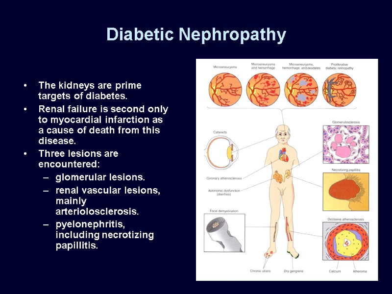 Diabetic Nephropathy The kidneys are prime targets of diabetes.  Renal failure is second